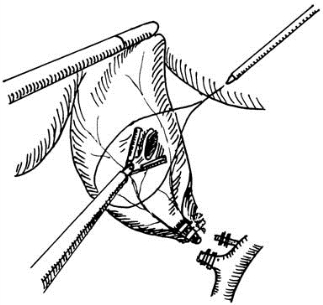 pagenumber_ebook=458,pagenumber_book=443