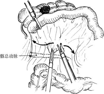 pagenumber_ebook=397,pagenumber_book=382