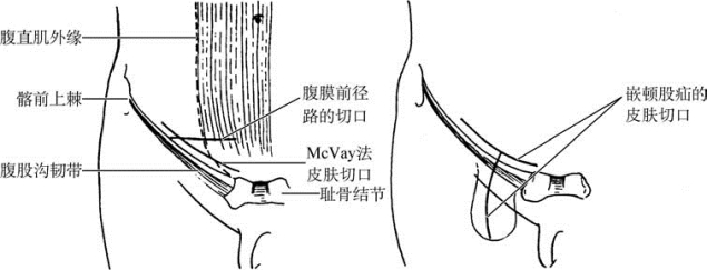 pagenumber_ebook=595,pagenumber_book=580