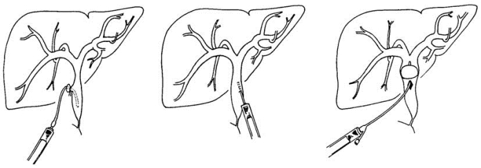 pagenumber_ebook=442,pagenumber_book=427