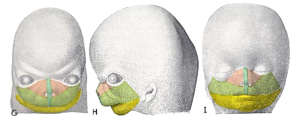 1.2-8 胚胎第7-8周.jpg