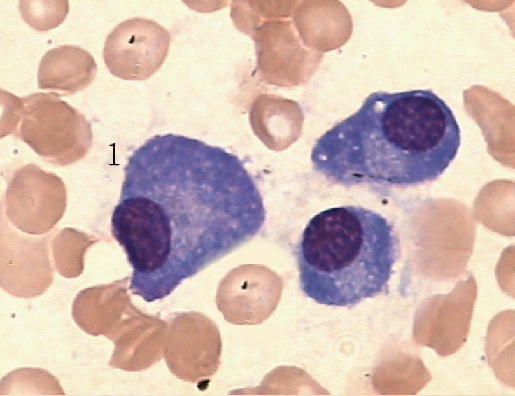 此骨髓片中标号为1的细胞为