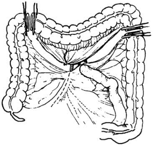pagenumber_ebook=360,pagenumber_book=345