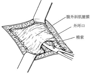 pagenumber_ebook=588,pagenumber_book=573