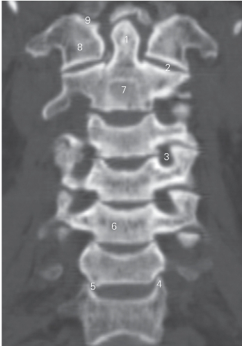 pagenumber_ebook=12,pagenumber_book=3
