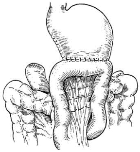 pagenumber_ebook=327,pagenumber_book=312