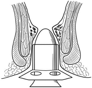 pagenumber_ebook=609,pagenumber_book=594