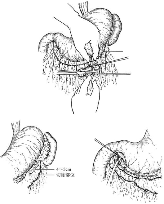 pagenumber_ebook=324,pagenumber_book=309