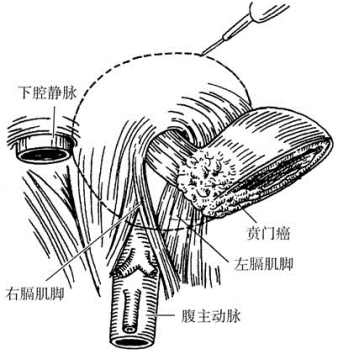 pagenumber_ebook=317,pagenumber_book=302