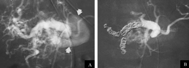 pagenumber_ebook=281,pagenumber_book=266