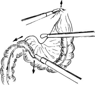 pagenumber_ebook=425,pagenumber_book=410