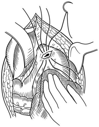 pagenumber_ebook=562,pagenumber_book=547