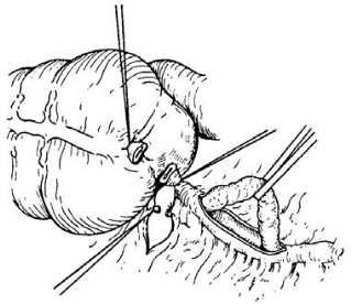 pagenumber_ebook=547,pagenumber_book=532