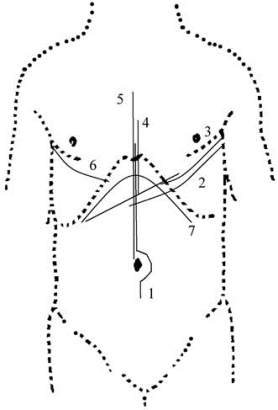 pagenumber_ebook=309,pagenumber_book=294