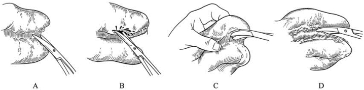 pagenumber_ebook=47,pagenumber_book=32