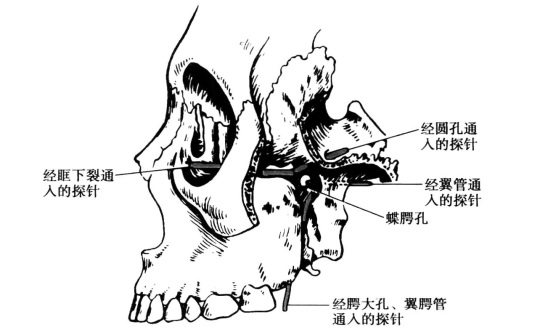 pagenumber_ebook=118,pagenumber_book=109