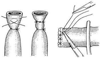 pagenumber_ebook=261,pagenumber_book=246