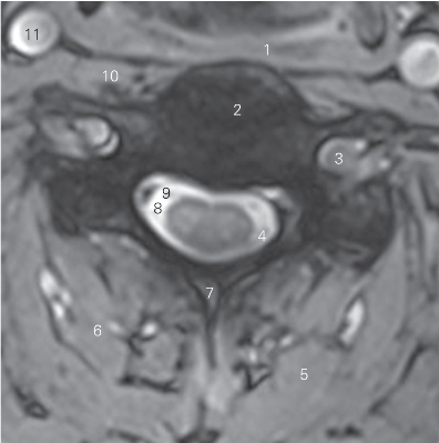 pagenumber_ebook=13,pagenumber_book=4