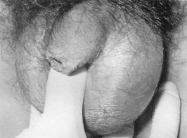 pagenumber_ebook=79,pagenumber_book=68