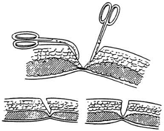 pagenumber_ebook=78,pagenumber_book=63