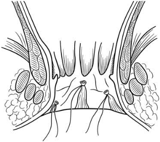 pagenumber_ebook=606,pagenumber_book=591
