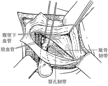 pagenumber_ebook=596,pagenumber_book=581