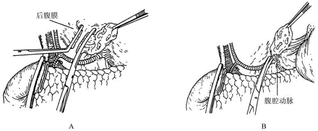 pagenumber_ebook=338,pagenumber_book=323