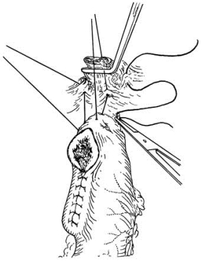 pagenumber_ebook=321,pagenumber_book=306