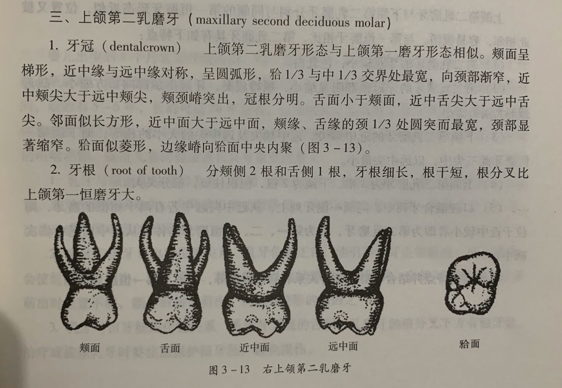上颌第二乳磨牙.png