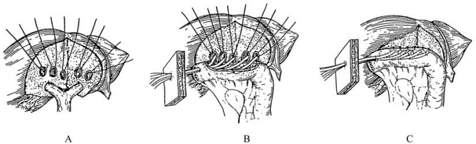 pagenumber_ebook=456,pagenumber_book=441