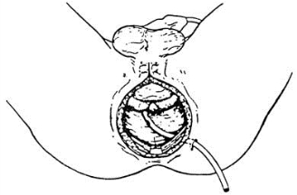 pagenumber_ebook=413,pagenumber_book=398