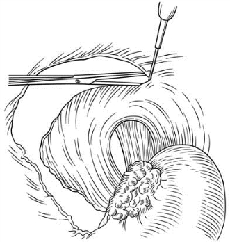 pagenumber_ebook=317,pagenumber_book=302