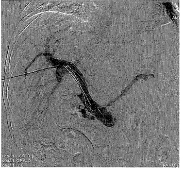 pagenumber_ebook=268,pagenumber_book=260