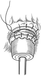 pagenumber_ebook=608,pagenumber_book=593