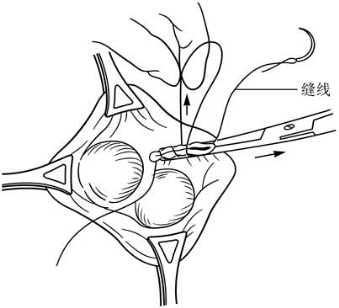 pagenumber_ebook=601,pagenumber_book=586