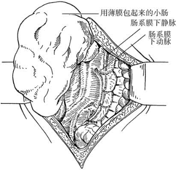 pagenumber_ebook=390,pagenumber_book=375