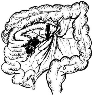 pagenumber_ebook=560,pagenumber_book=545