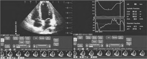pagenumber_ebook=257,pagenumber_book=257