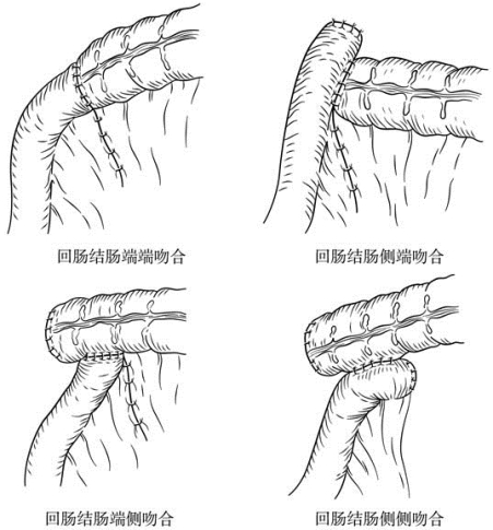pagenumber_ebook=381,pagenumber_book=366
