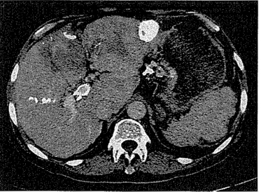 pagenumber_ebook=268,pagenumber_book=260