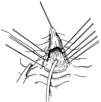 pagenumber_ebook=444,pagenumber_book=429