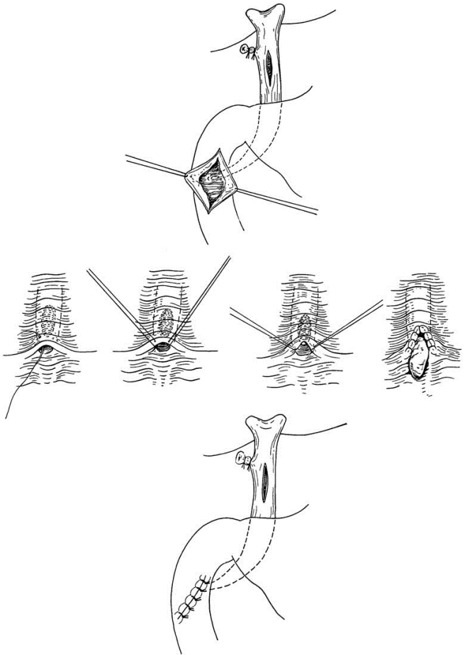 pagenumber_ebook=440,pagenumber_book=425