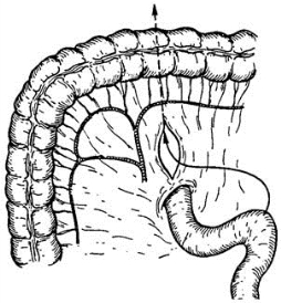 pagenumber_ebook=327,pagenumber_book=312
