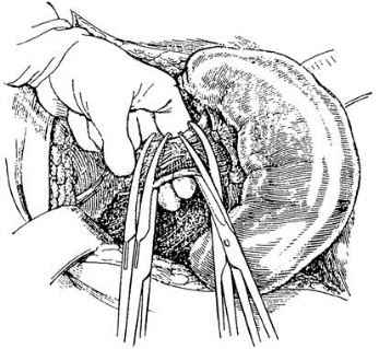 pagenumber_ebook=504,pagenumber_book=489