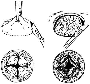 pagenumber_ebook=411,pagenumber_book=396