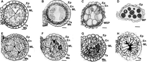 Transverse-section-comparison-of-the-anther-development-in-wild-type-and-gamyb-4-mutant.png