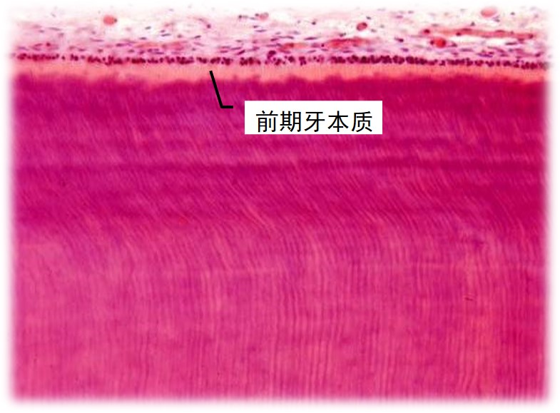3.2-8 前期牙本质.jpg