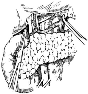 pagenumber_ebook=361,pagenumber_book=346