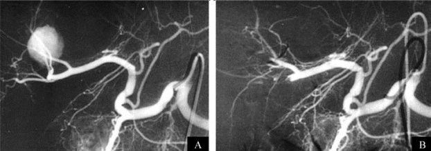 pagenumber_ebook=281,pagenumber_book=266