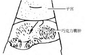 pagenumber_ebook=691,pagenumber_book=691